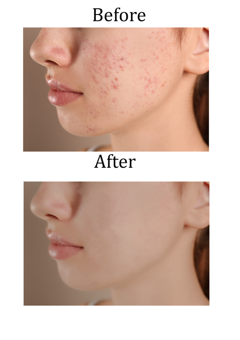 retouching